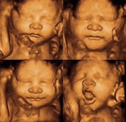 2D/3D/4D HD live pretecho consult van 30 minuten.