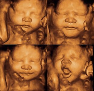 3D/4D HD live pretecho consult van 15 minuten.